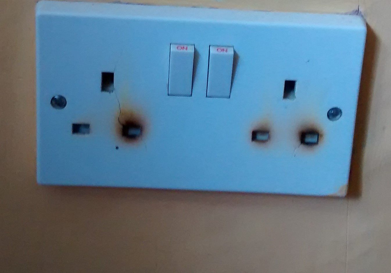 socket burns